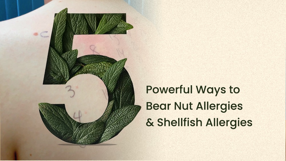 Nut allergies