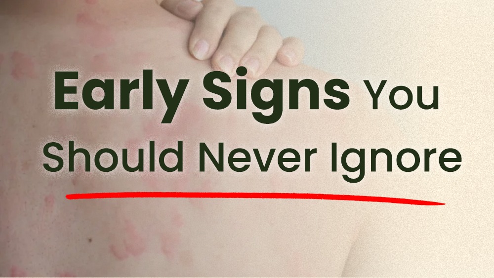 allergic reaction to peanuts peanut allergy